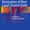 Restoration of Root Canal-Treated Teeth: An Adhesive Dentistry Perspective