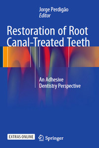 Restoration of Root Canal-Treated Teeth: An Adhesive Dentistry Perspective