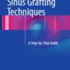 Sinus Grafting Techniques: A Step-by-Step Guide