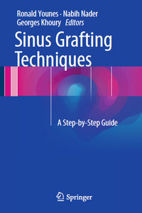 Sinus Grafting Techniques: A Step-by-Step Guide