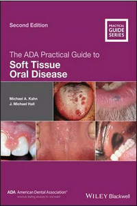 The ADA Practical Guide to Soft Tissue Oral Disease, 2nd Edition