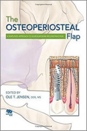 The Osteoperiosteal Flap: A Simplified Approach to Alveolar Bone Reconstruction