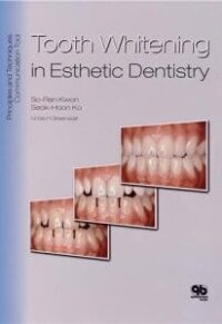 Tooth Whitening in Esthetic Dentistry: Principles and Techniques