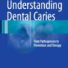 Understanding Dental Caries