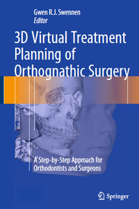 3D Virtual Treatment Planning of Orthognathic Surgery