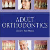 Adult Orthodontics, 1st Edition