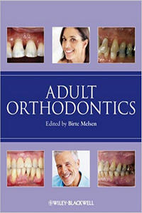 Adult Orthodontics, 1st Edition