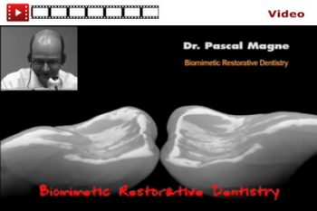 Biomimetic Restorative Dentistry