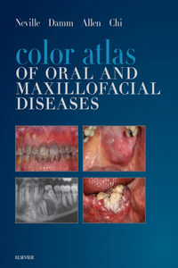 Color Atlas of Oral and Maxillofacial Diseases