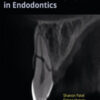 Cone Beam Computed Tomography in Endodontics
