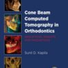 Cone Beam Computed Tomography in Orthodontics