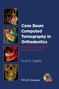 Cone Beam Computed Tomography in Orthodontics