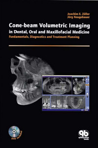 Cone Beam Volumetric Imaging in Dental, Oral and Maxillofacial Medicine