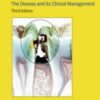 Dental Caries: The Disease and Its Clinical Management, 3rd Edition