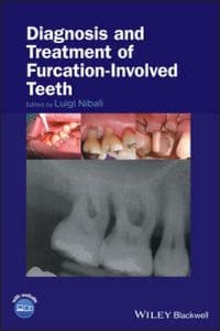 Diagnosis and Treatment of Furcation‐Involved Teeth