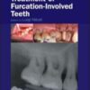 Diagnosis and Treatment of Furcation‐Involved Teeth
