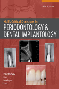 Hall’s Critical Decisions in Periodontology and Dental Implantology, 5th Edition