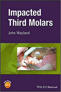Impacted Third Molars, 1st Edition