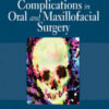 Management of Complications in Oral and Maxillofacial Surgery