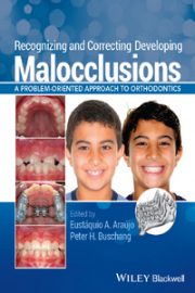 Recognizing and correcting developing malocclusions