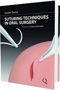 Suturing Techniques in Oral Surgery