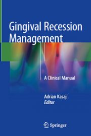 Gingival Recession Management: A Clinical Manual