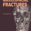 Surgical Management of Maxillofacial Fractures