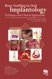 Bone Grafting in Oral Implantology: Techniques and Clinical Applications