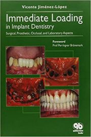 Immediate Loading in Implant Dentistry: Surgical, Prosthetic, Occlusal and Laboratory Aspects