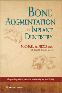 Bone Augmentation in Implant Dentistry