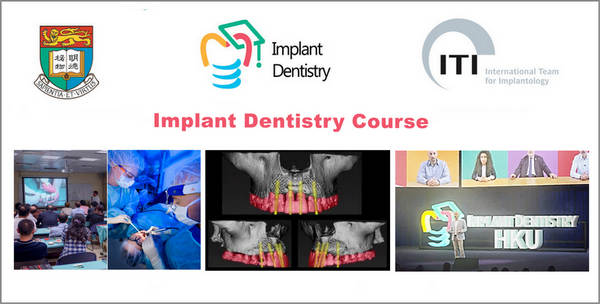 Implant Dentistry Course (The University of Hong Kong)