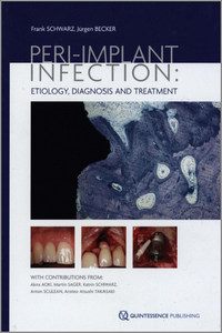 Peri-implant Infection: Etiology, Diagnosis and Treatment