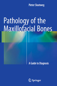 Pathology of the Maxillofacial Bones: A Guide to Diagnosis
