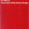 An Atlas of Removable Partial Denture Design