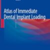 Atlas Of Immediate Dental Implant Loading