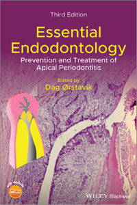 Essential Endodontology: Prevention and Treatment of Apical Periodontitis, 3rd Edition