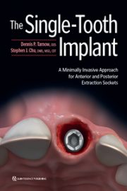 The Single-Tooth Implant: A Minimally Invasive Approach for Anterior and Posterior Extraction Sockets