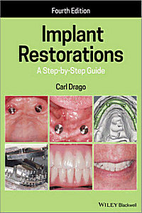 Implant Restorations: A Step-by-Step Guide, 4th Edition