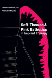 Soft Tissues and Pink Esthetics in Implant Therapy