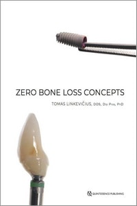 Zero Bone Loss Concepts