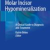 Molar Incisor Hypomineralization: A Clinical Guide to Diagnosis and Treatment