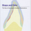 Shape and Color: The Key to Successful Ceramic Restorations