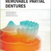 Kratochvil’s Fundamentals of Removable Partial Dentures