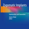 Zygomatic Implants: Optimization and Innovation