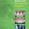 Practical Advanced Periodontal Surgery, 2nd Edition