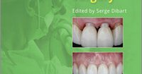 Practical Advanced Periodontal Surgery, 2nd Edition