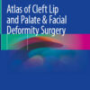 Atlas of Cleft Lip and Palate & Facial Deformity Surgery