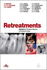 Retreatments Solutions for Periapical Diseases of Endodontic Origin