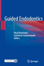 Guided Endodontics