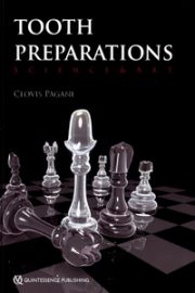 Tooth Preparations: Science & Art